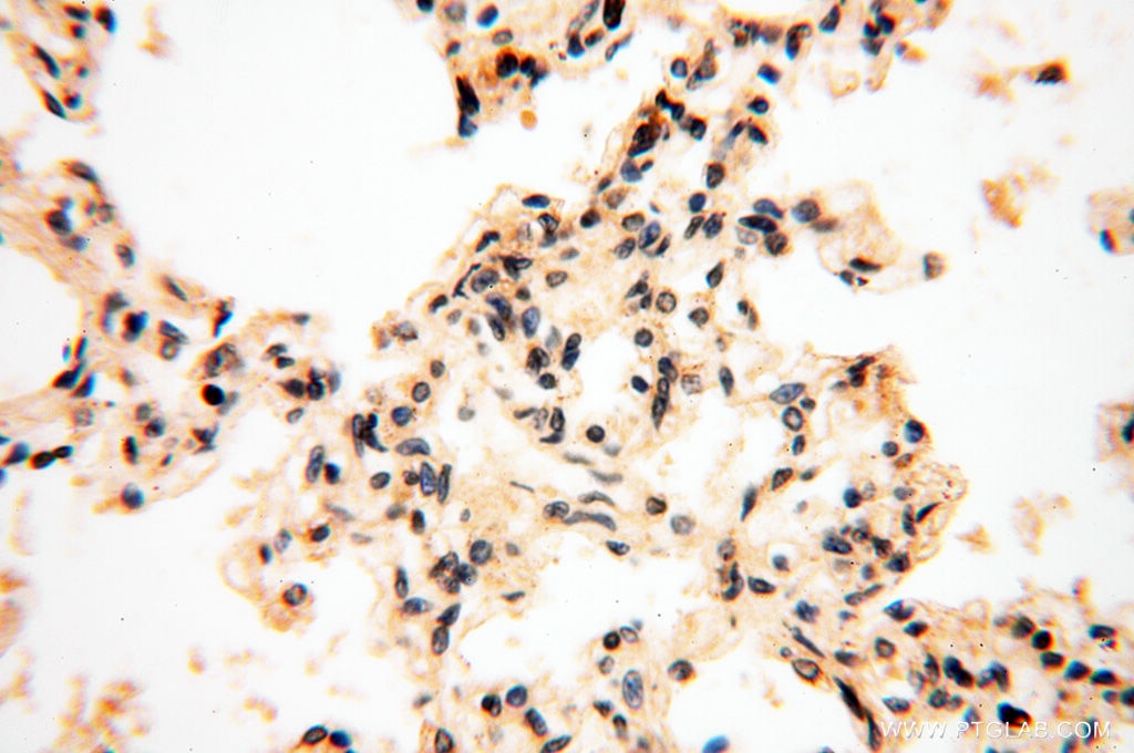 IHC staining of human lung using 17893-1-AP
