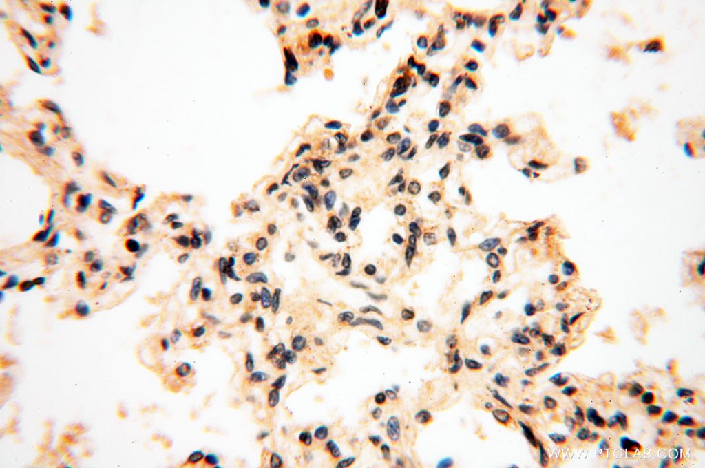 Immunohistochemistry (IHC) staining of human lung tissue using CTTNBP2 Polyclonal antibody (17893-1-AP)