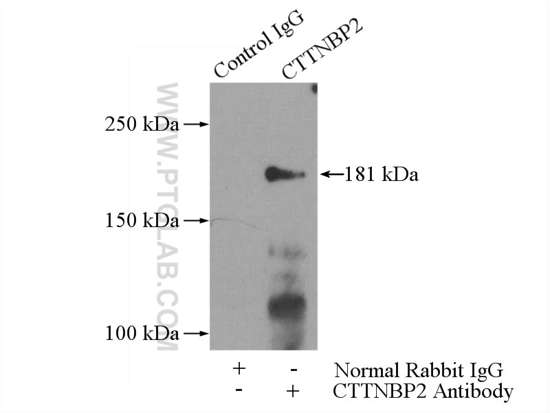 Immunoprecipitation (IP) experiment of mouse brain tissue using CTTNBP2 Polyclonal antibody (17893-1-AP)