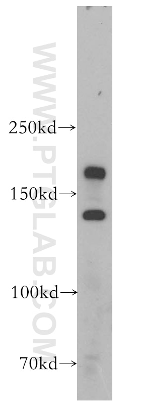 Western Blot (WB) analysis of mouse kidney tissue using CTTNBP2 Polyclonal antibody (17893-1-AP)