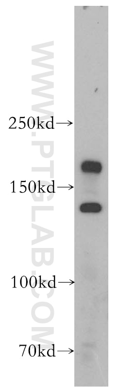 WB analysis of mouse kidney using 17893-1-AP