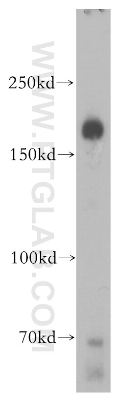 Western Blot (WB) analysis of mouse brain tissue using CTTNBP2 Polyclonal antibody (17893-1-AP)