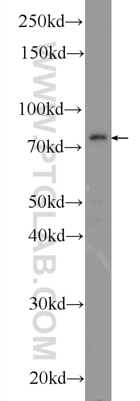 Western Blot (WB) analysis of MDA-MB-453s cells using CTTNBP2NL Polyclonal antibody (25523-1-AP)