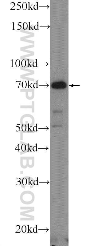 Western Blot (WB) analysis of mouse skin tissue using CTTNBP2NL Polyclonal antibody (25523-1-AP)