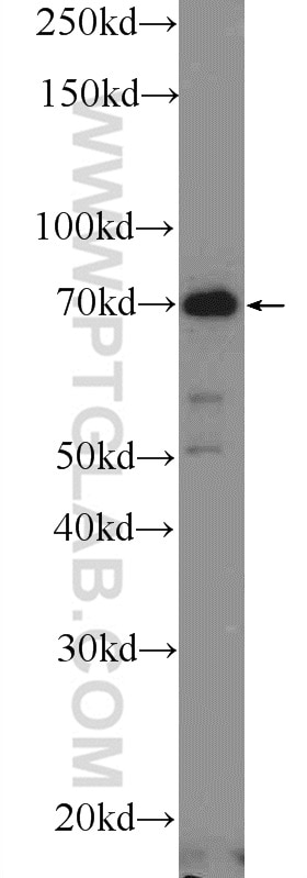 WB analysis of mouse skin using 25523-1-AP