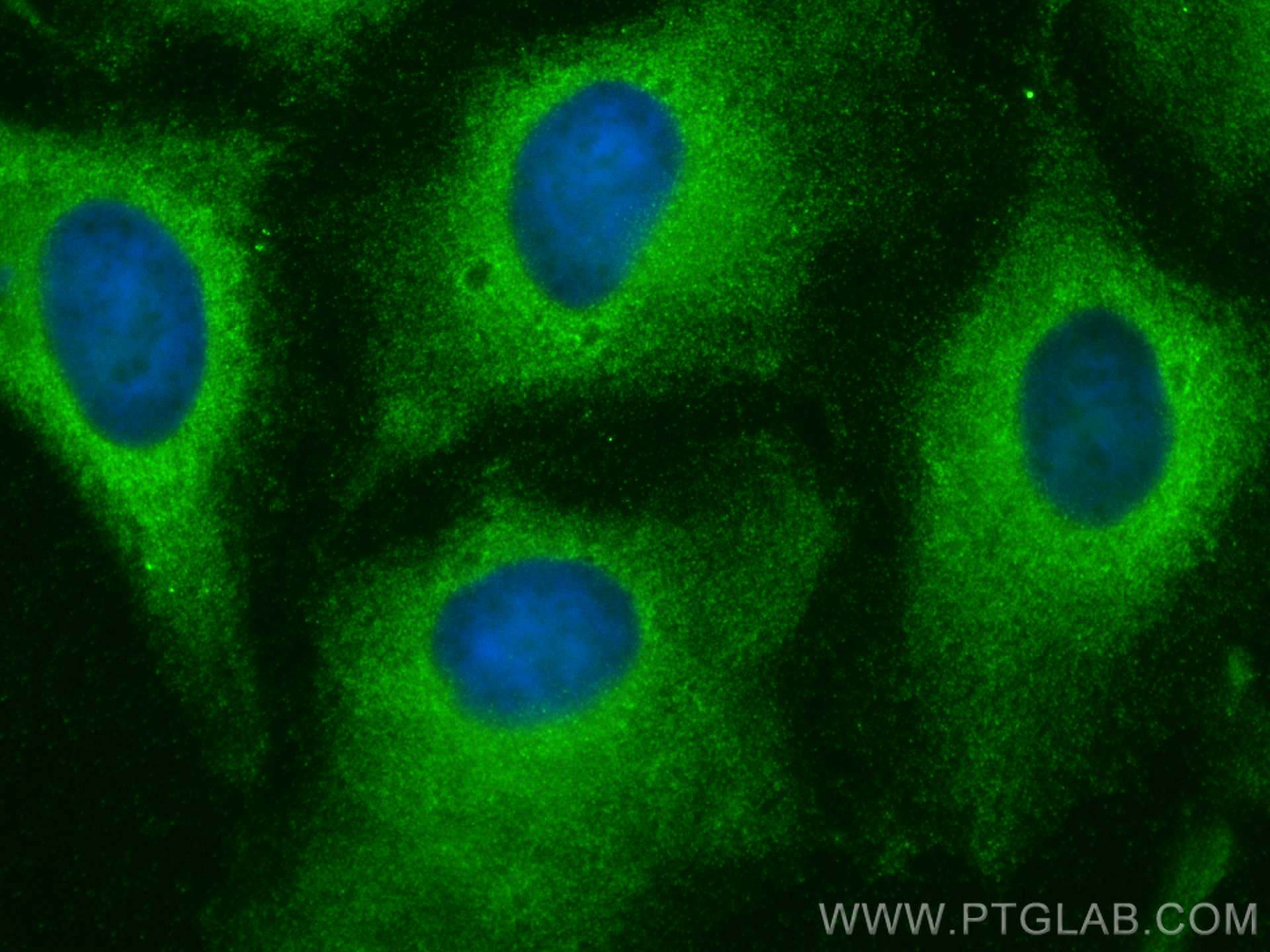 IF Staining of HeLa using 20123-1-AP