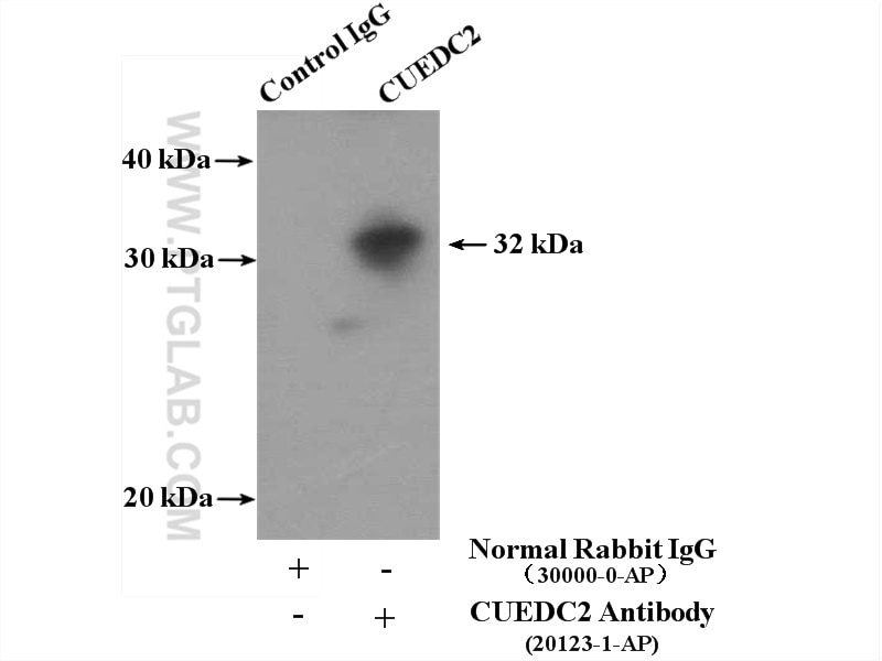 Immunoprecipitation (IP) experiment of mouse brain tissue using CUEDC2 Polyclonal antibody (20123-1-AP)