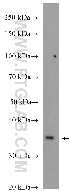 WB analysis of mouse kidney using 20123-1-AP