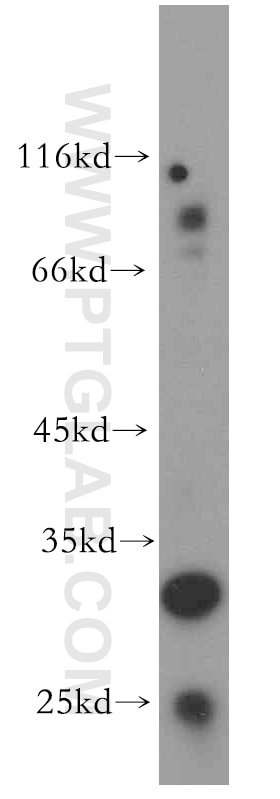 Western Blot (WB) analysis of human brain tissue using CUEDC2 Polyclonal antibody (20123-1-AP)