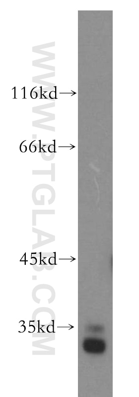 Western Blot (WB) analysis of human kidney tissue using CUEDC2 Polyclonal antibody (20123-1-AP)