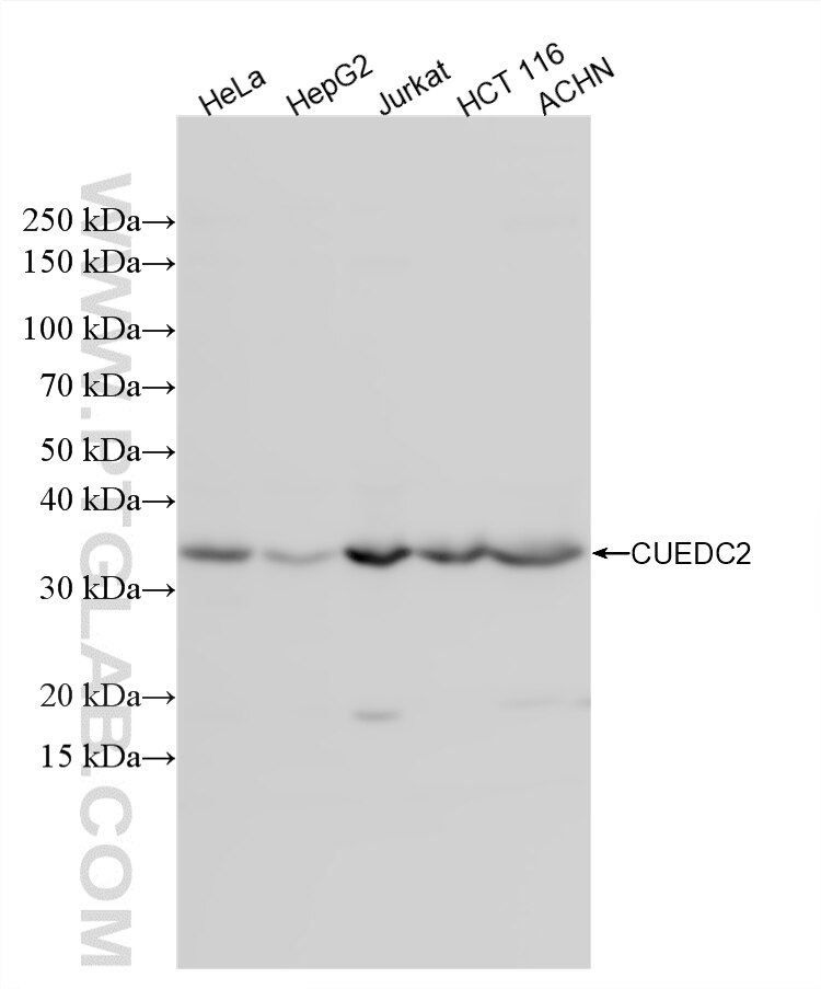Various lysates were subjected to SDS PAGE followed by western blot with 86610-2-RR (CUEDC2 antibody) at dilution of 1:2000 incubated at room temperature for 1.5 hours. Western Blot (WB) analysis of various lysates using CUEDC2 Recombinant monoclonal antibody (86610-2-RR)