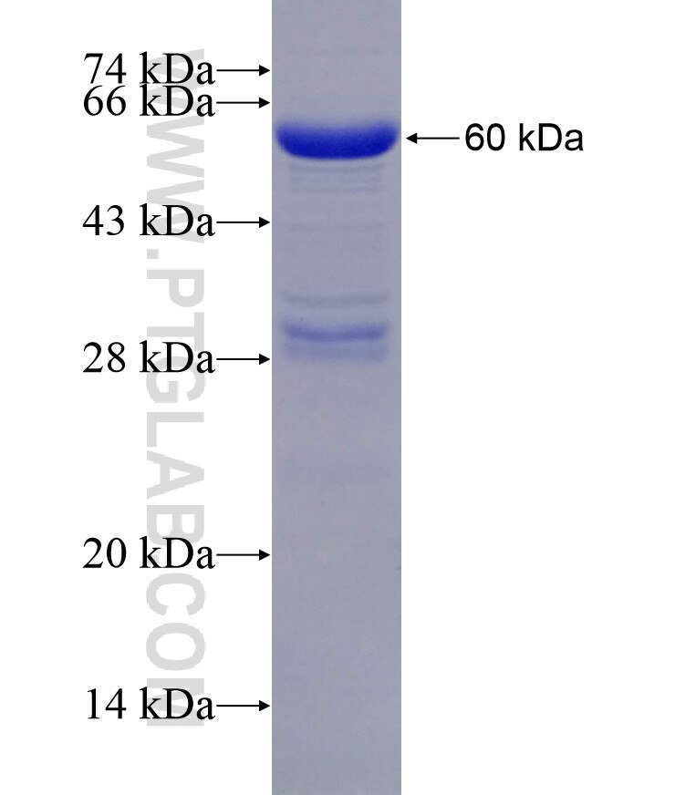 CUEDC2 fusion protein Ag13847 SDS-PAGE