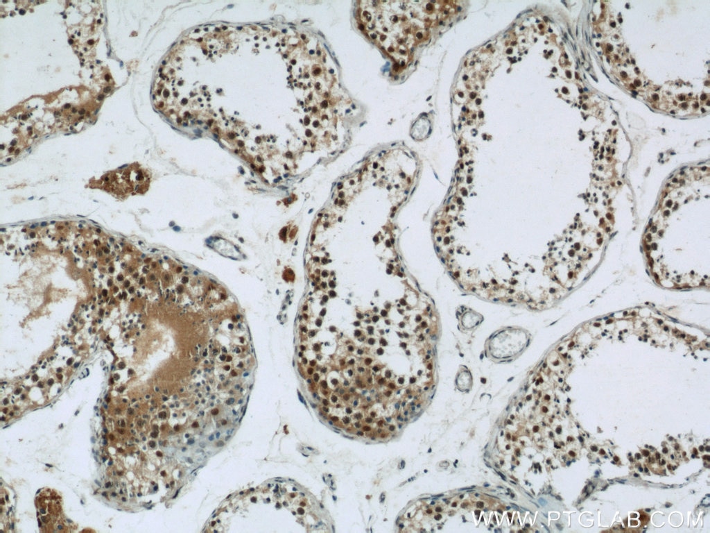 Immunohistochemistry (IHC) staining of human testis tissue using CUGBP1 Polyclonal antibody (13002-1-AP)