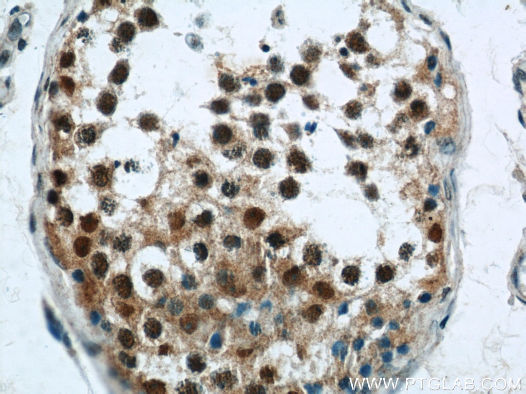 Immunohistochemistry (IHC) staining of human testis tissue using CUGBP1 Polyclonal antibody (13002-1-AP)