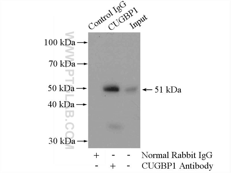 Immunoprecipitation (IP) experiment of HeLa cells using CUGBP1 Polyclonal antibody (13002-1-AP)