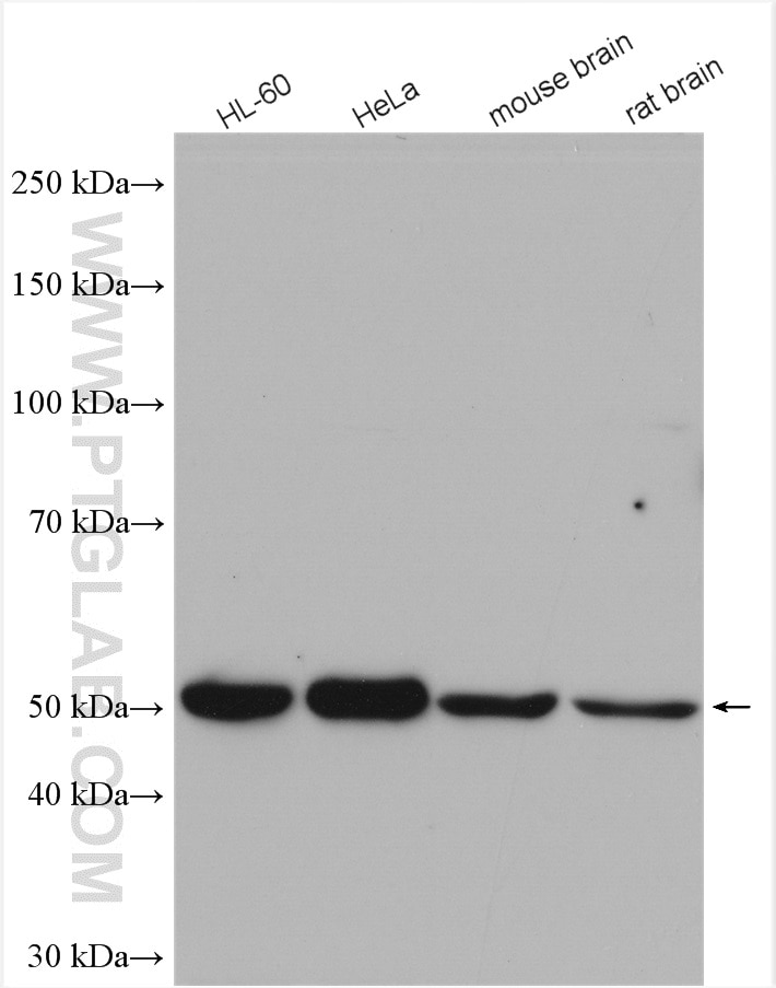 Western Blot (WB) analysis of various lysates using CUGBP1 Polyclonal antibody (13002-1-AP)