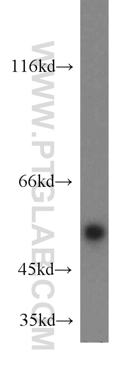 Western Blot (WB) analysis of HeLa cells using CUGBP1 Polyclonal antibody (13002-1-AP)