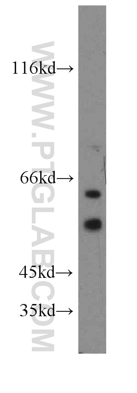 Western Blot (WB) analysis of NIH/3T3 cells using CUGBP1 Polyclonal antibody (13002-1-AP)