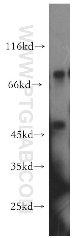 Western Blot (WB) analysis of HT-1080 cells using CUGBP1 Polyclonal antibody (13002-1-AP)