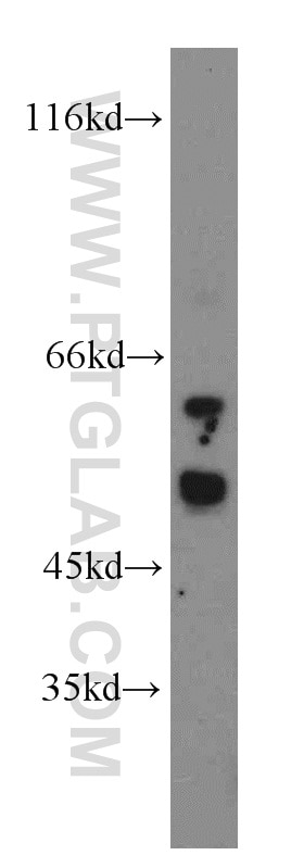 Western Blot (WB) analysis of HL-60 cells using CUGBP1 Polyclonal antibody (13002-1-AP)