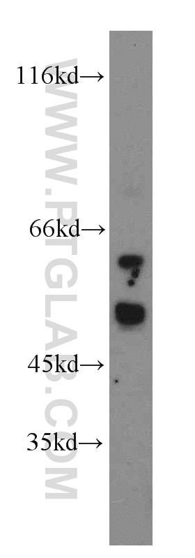 WB analysis of HL-60 using 13002-1-AP