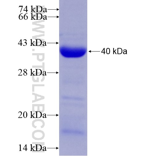 CUGBP1 fusion protein Ag14605 SDS-PAGE