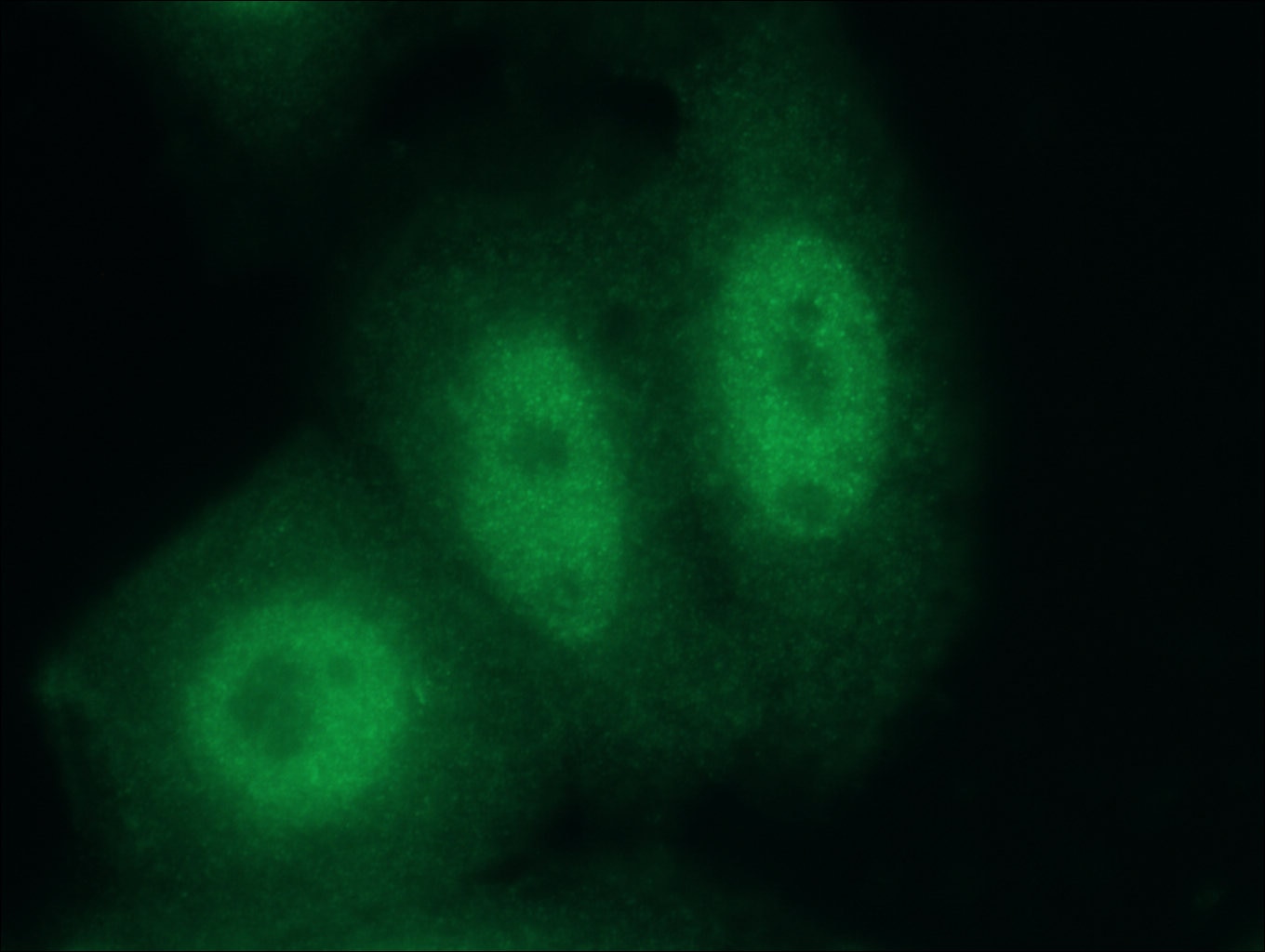 Immunofluorescence (IF) / fluorescent staining of HepG2 cells using CUGBP2 Polyclonal antibody (12921-1-AP)