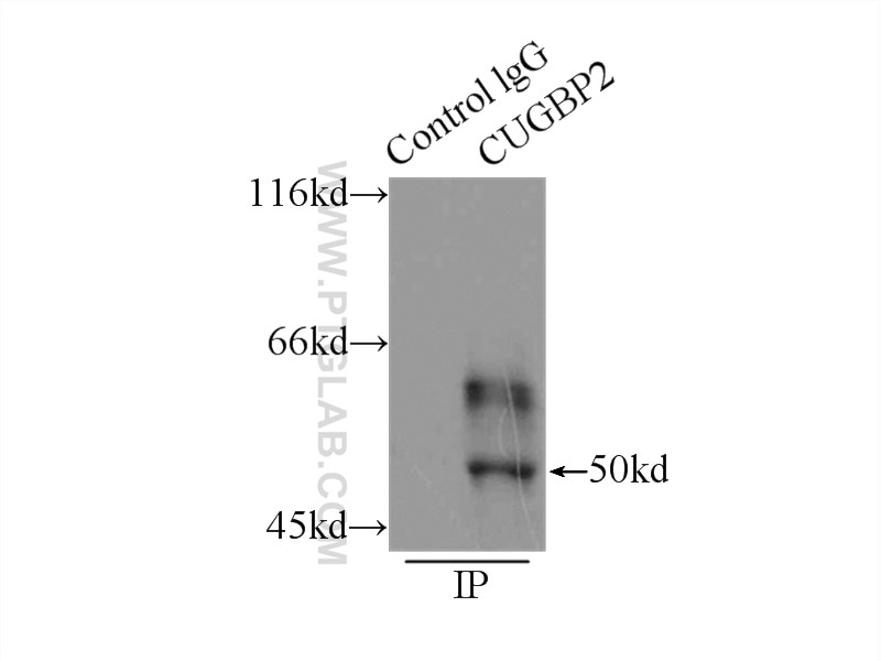 Immunoprecipitation (IP) experiment of mouse skeletal muscle tissue using CUGBP2 Polyclonal antibody (12921-1-AP)
