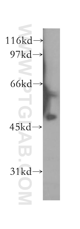 Western Blot (WB) analysis of mouse thymus tissue using CUGBP2 Polyclonal antibody (12921-1-AP)