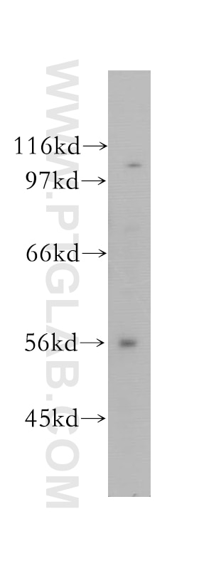 Western Blot (WB) analysis of K-562 cells using CUGBP2 Polyclonal antibody (12921-1-AP)