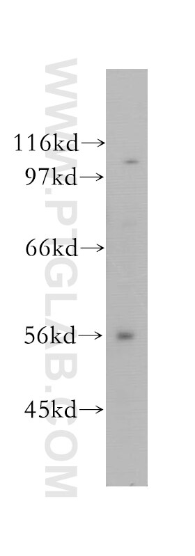 Western Blot (WB) analysis of K-562 cells using CUGBP2 Polyclonal antibody (12921-1-AP)