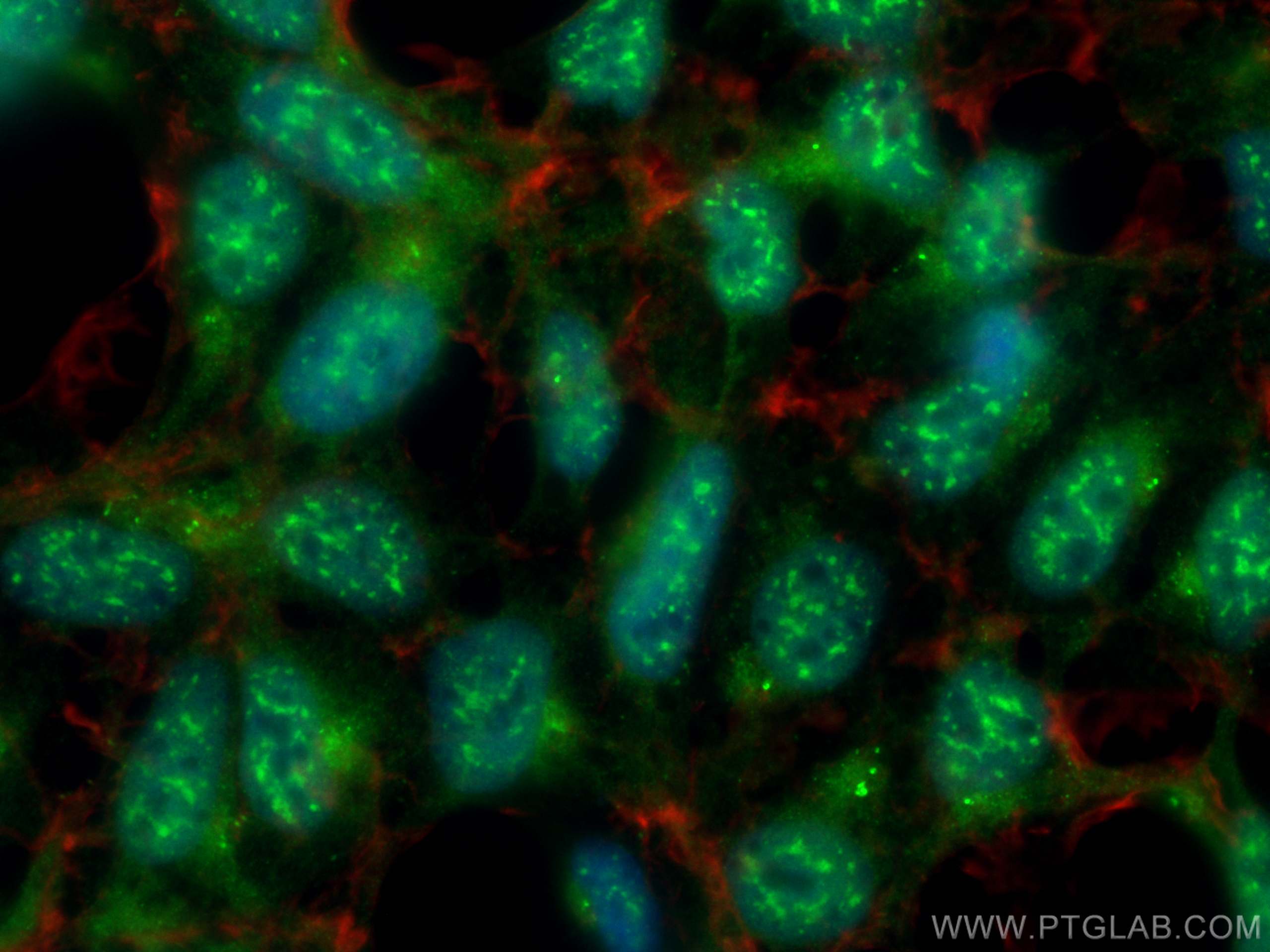 IF Staining of HEK-293 using CL488-82474