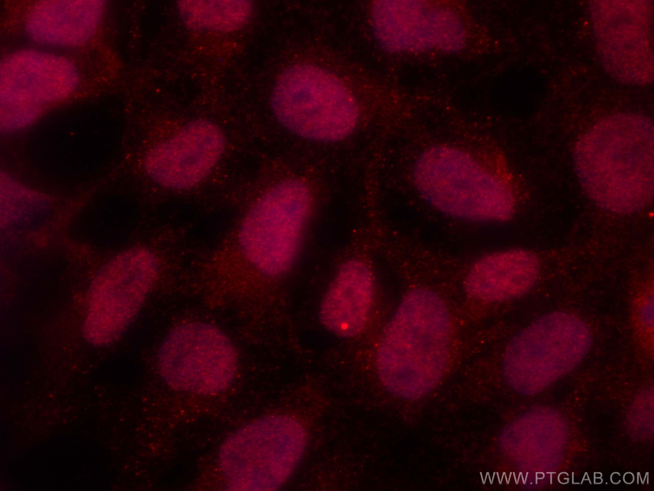 Immunofluorescence (IF) / fluorescent staining of HEK-293 cells using CoraLite®594-conjugated CUL1 Monoclonal antibody (CL594-66978)