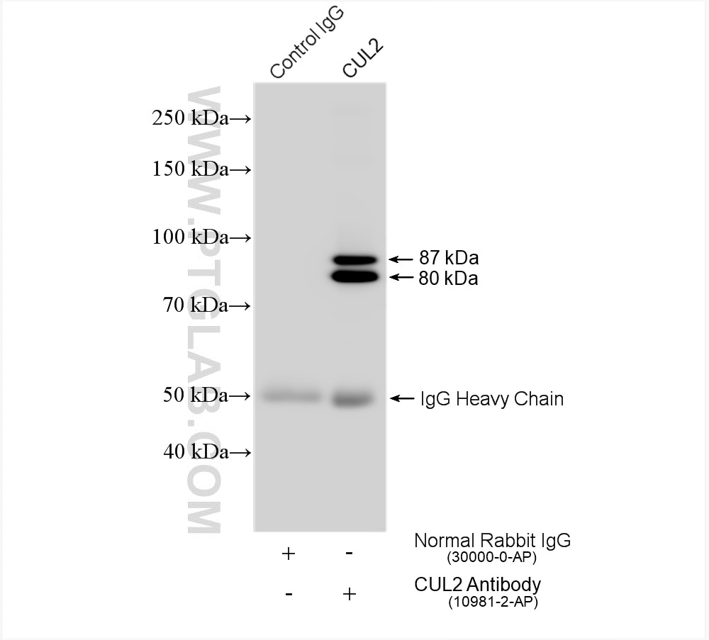 IP experiment of HeLa using 10981-2-AP