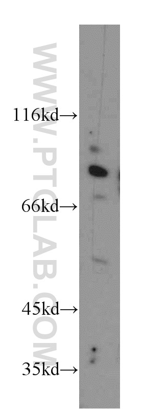 CUL4A-Specific antibody (14851-1-AP) | Proteintech