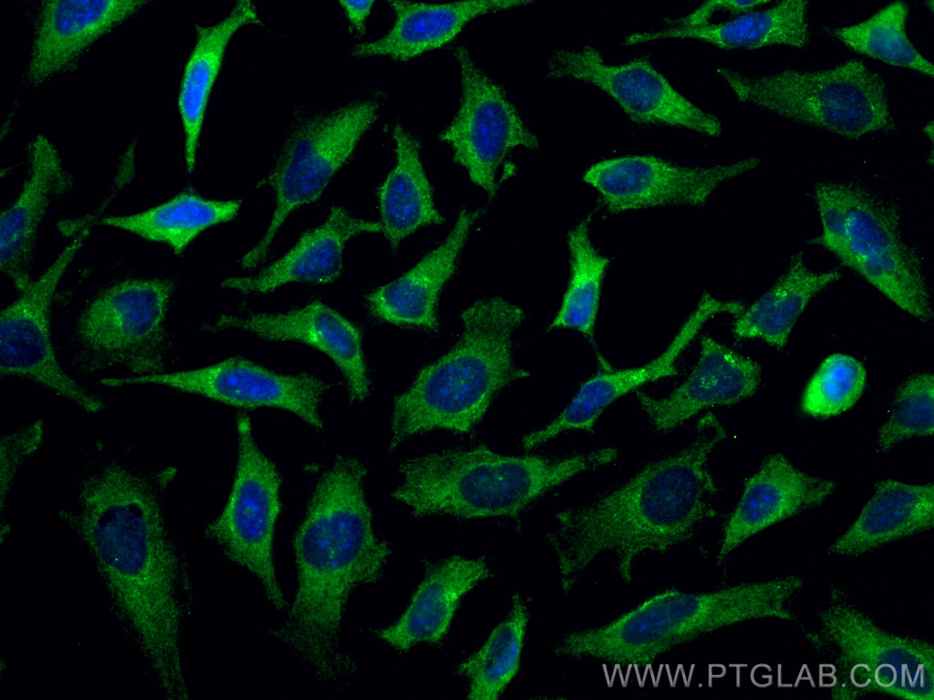 Immunofluorescence (IF) / fluorescent staining of HeLa cells using CUL2 Monoclonal antibody (67175-1-Ig)