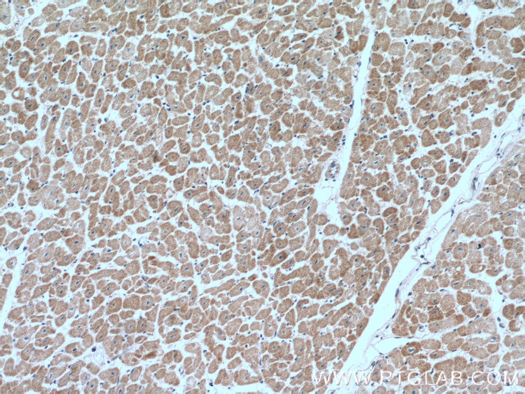 IHC staining of human heart using 10693-1-AP