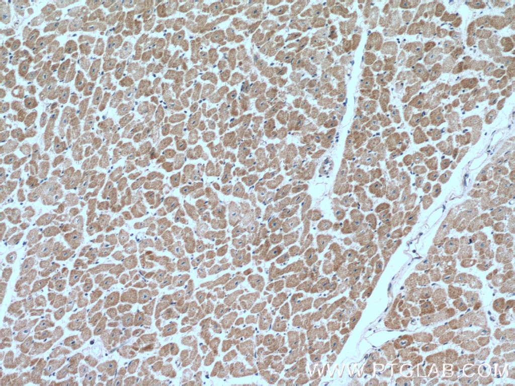 Immunohistochemistry (IHC) staining of human heart tissue using CUL4A Polyclonal antibody (10693-1-AP)