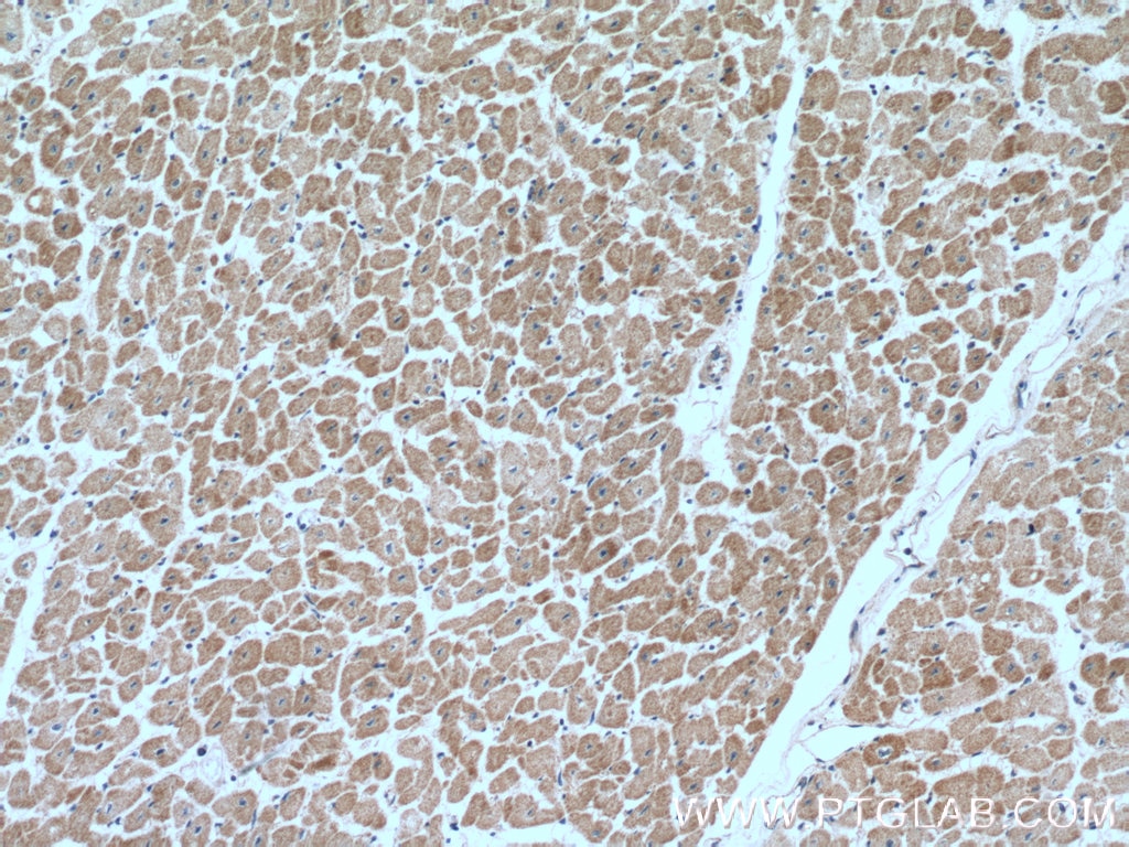 Immunohistochemistry (IHC) staining of human heart tissue using CUL4A Polyclonal antibody (10693-1-AP)