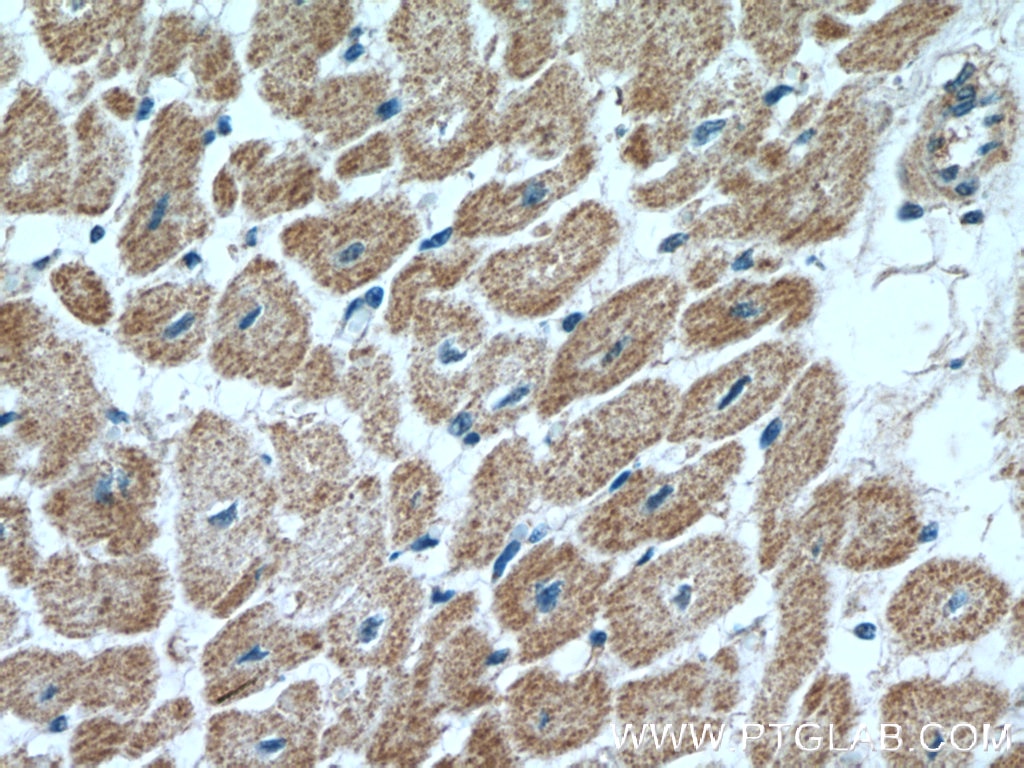 Immunohistochemistry (IHC) staining of human heart tissue using CUL4A Polyclonal antibody (10693-1-AP)