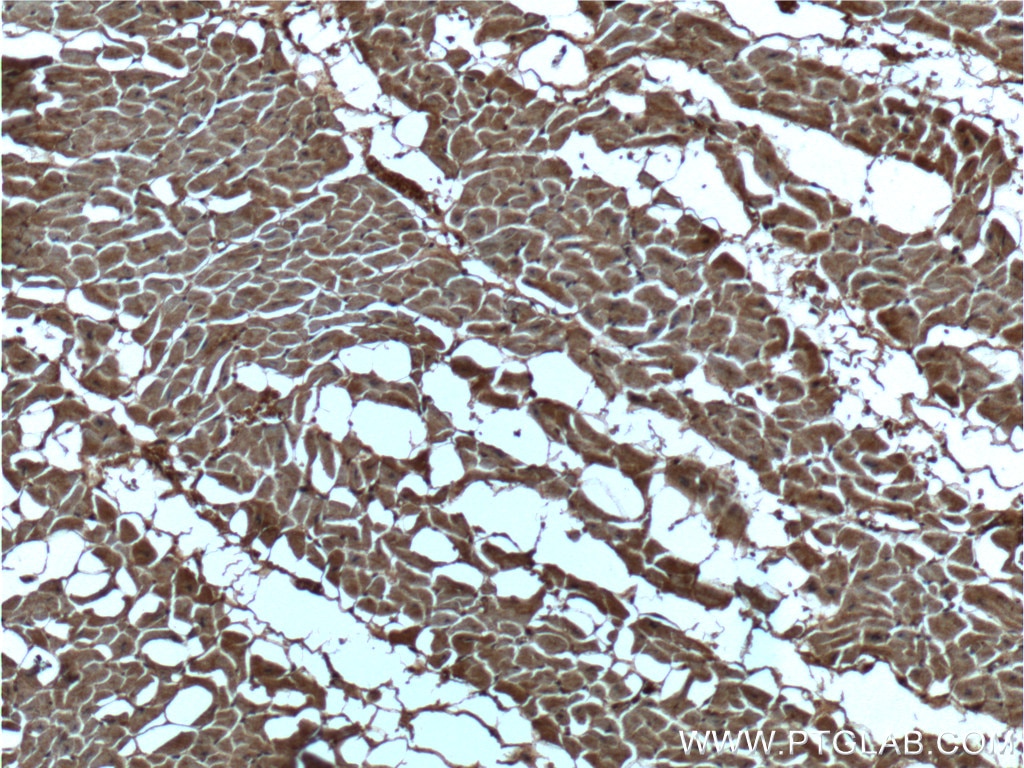 Immunohistochemistry (IHC) staining of human heart tissue using CUL4A Monoclonal antibody (66038-1-Ig)