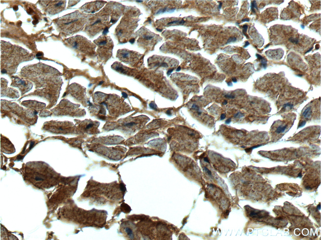 Immunohistochemistry (IHC) staining of human heart tissue using CUL4A Monoclonal antibody (66038-1-Ig)