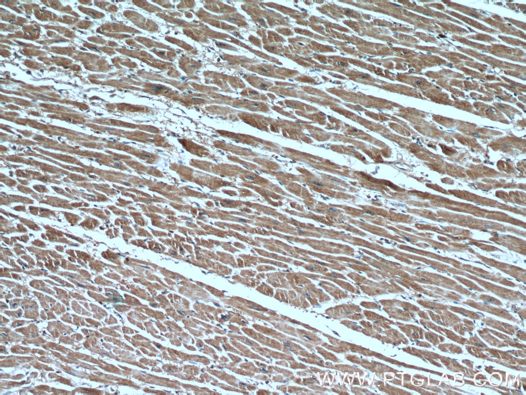 Immunohistochemistry (IHC) staining of human heart tissue using CUL4A Monoclonal antibody (66038-1-Ig)