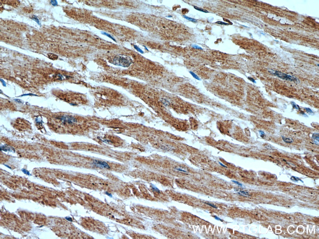 Immunohistochemistry (IHC) staining of human heart tissue using CUL4A Monoclonal antibody (66038-1-Ig)