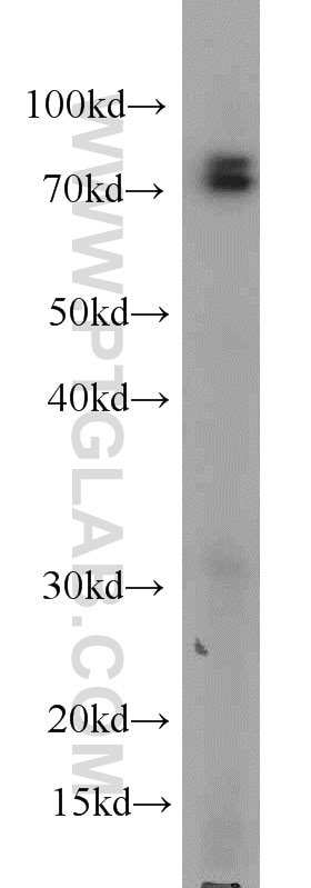 Western Blot (WB) analysis of HeLa cells using CUL4A Monoclonal antibody (66038-1-Ig)