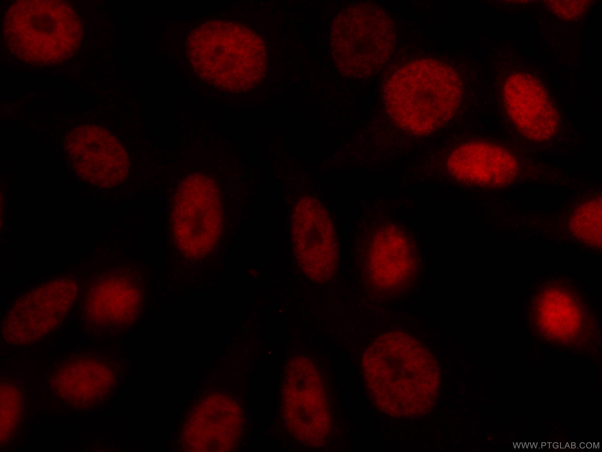 IF Staining of HepG2 using CL594-66038