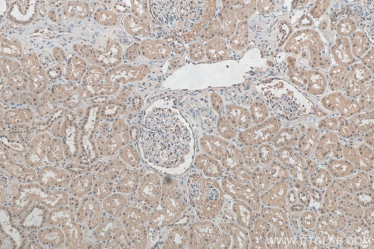Immunohistochemistry (IHC) staining of human kidney tissue using CUL4A-Specific Polyclonal antibody (14851-1-AP)
