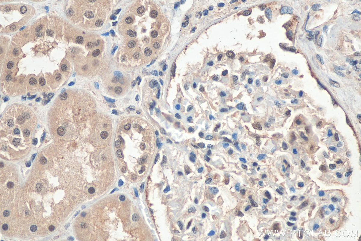 Immunohistochemistry (IHC) staining of human kidney tissue using CUL4A-Specific Polyclonal antibody (14851-1-AP)