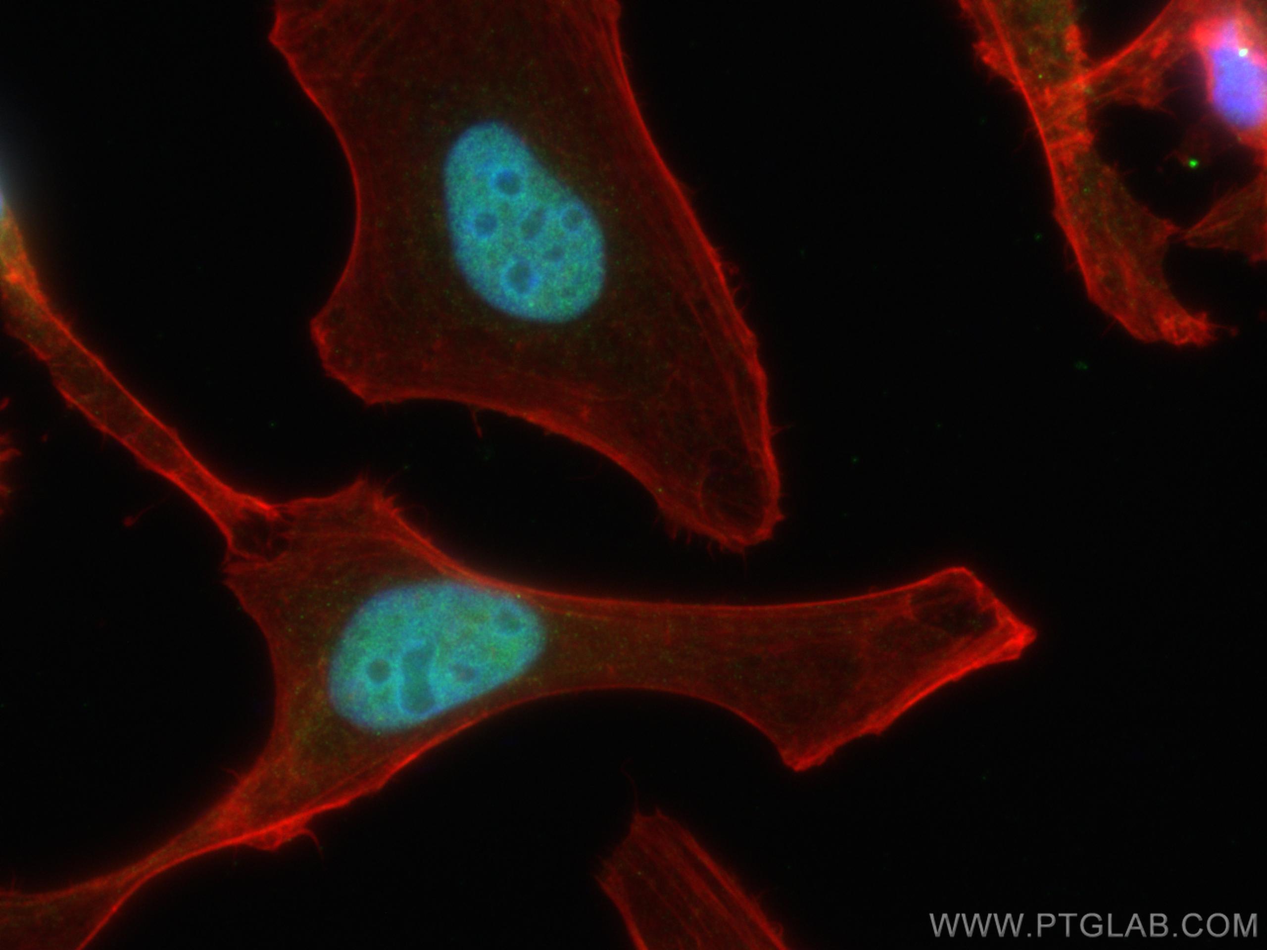 Immunofluorescence (IF) / fluorescent staining of HeLa cells using CUL4B Polyclonal antibody (12916-1-AP)