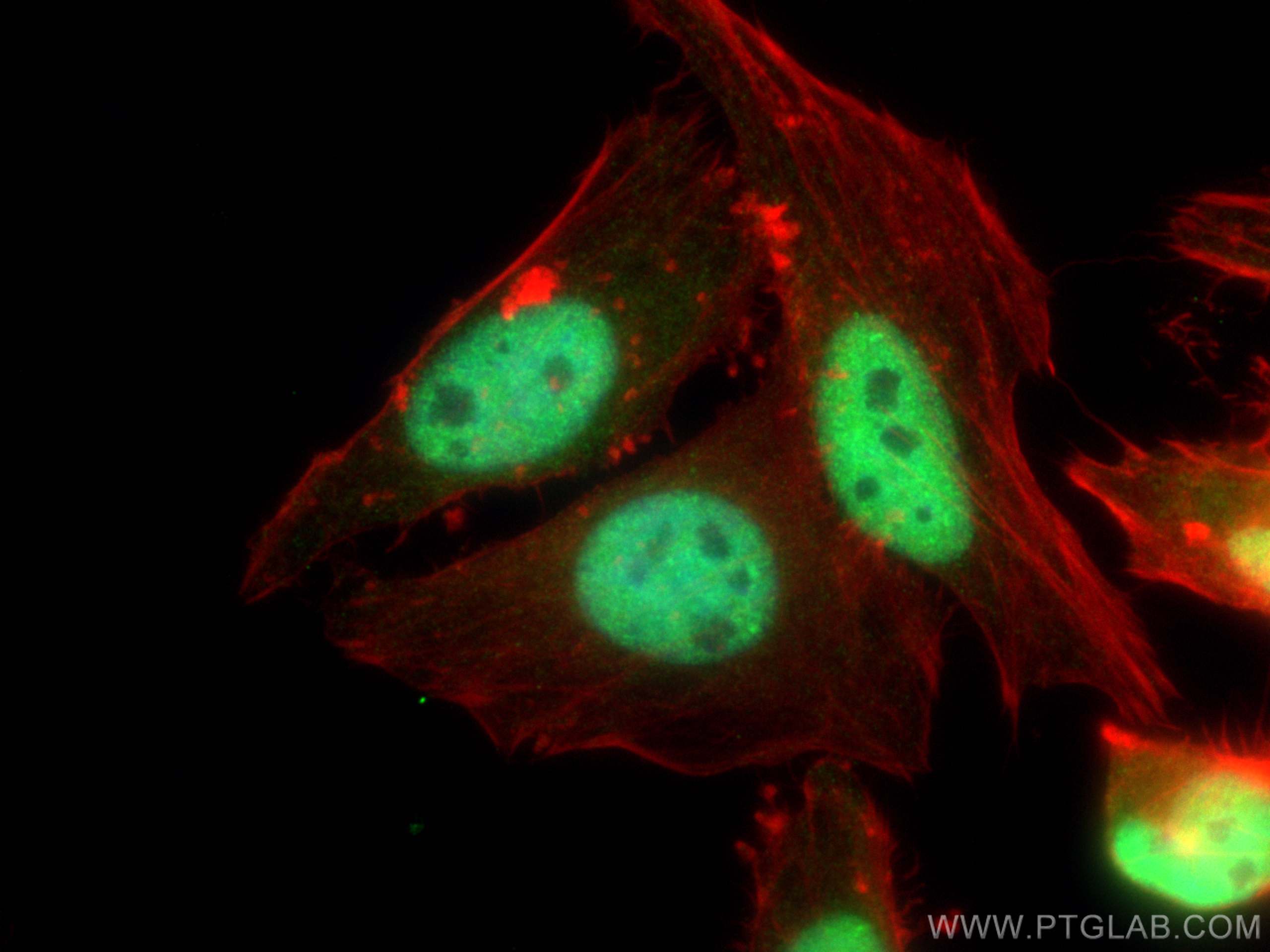 IF Staining of HeLa using 12916-1-AP